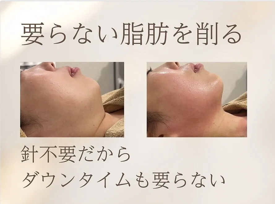 脂肪を減らす