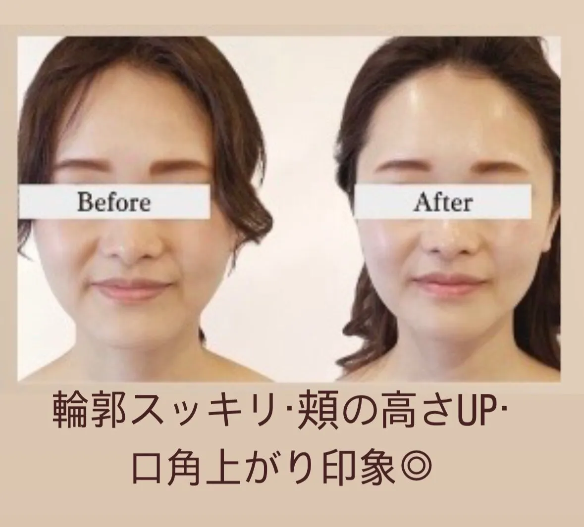 施術事例