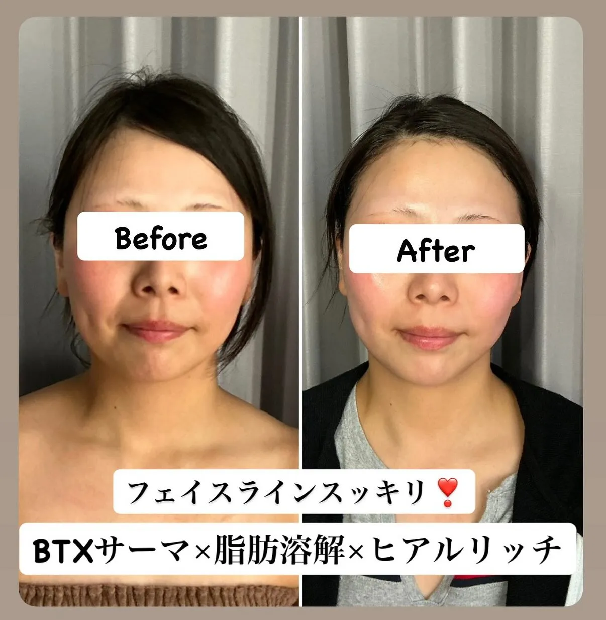 美意識が高く、お肌がお綺麗な方です。
