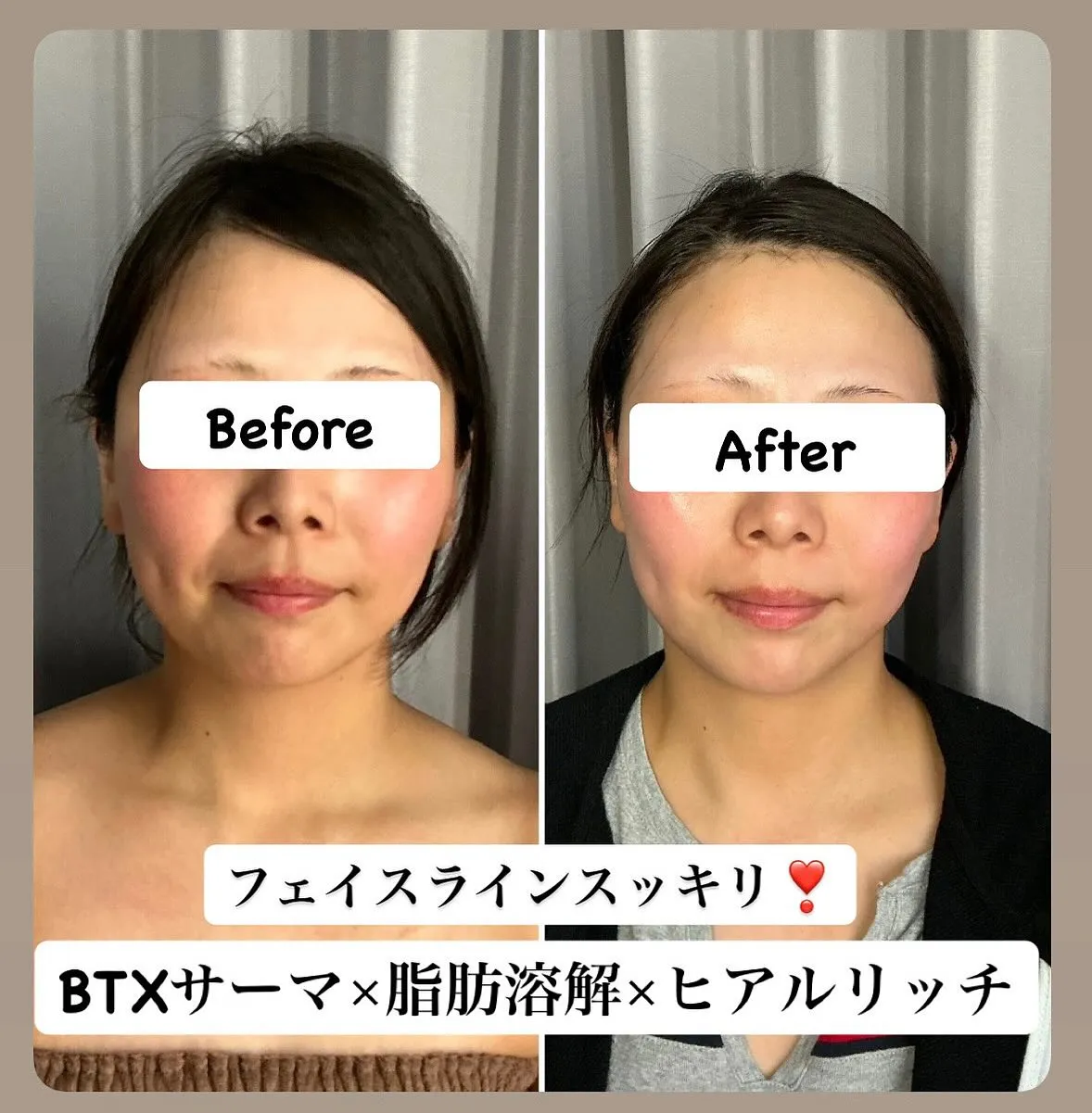 当サロンのNo.1贅沢フルコースで、輝く美肌と小顔を手に入れ...
