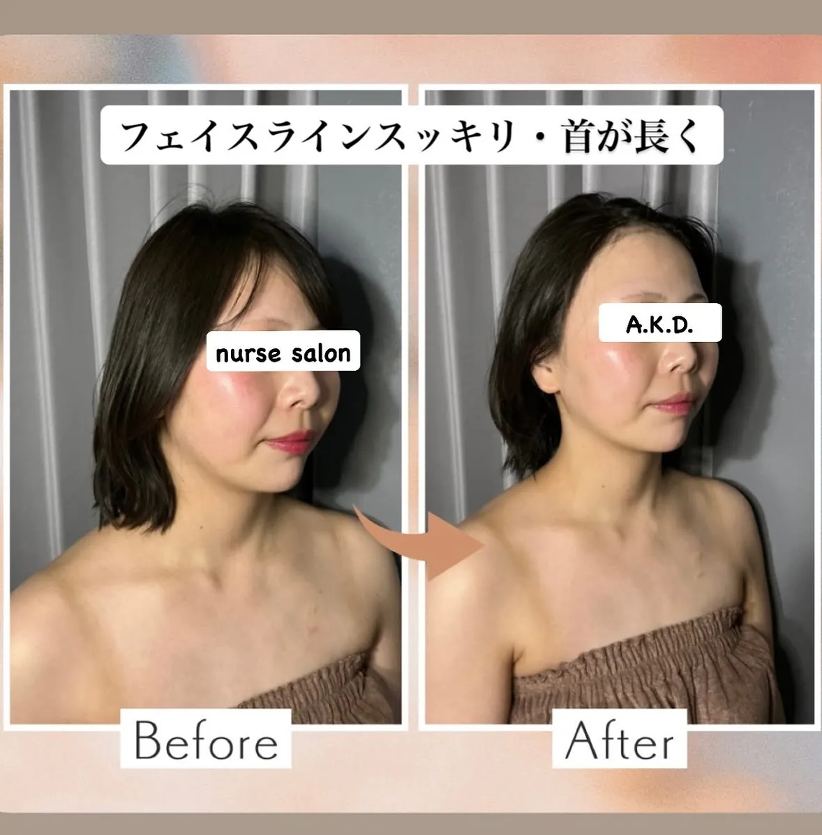 当サロンのNo.1贅沢フルコースで、輝く美肌と小顔を手に入れ...
