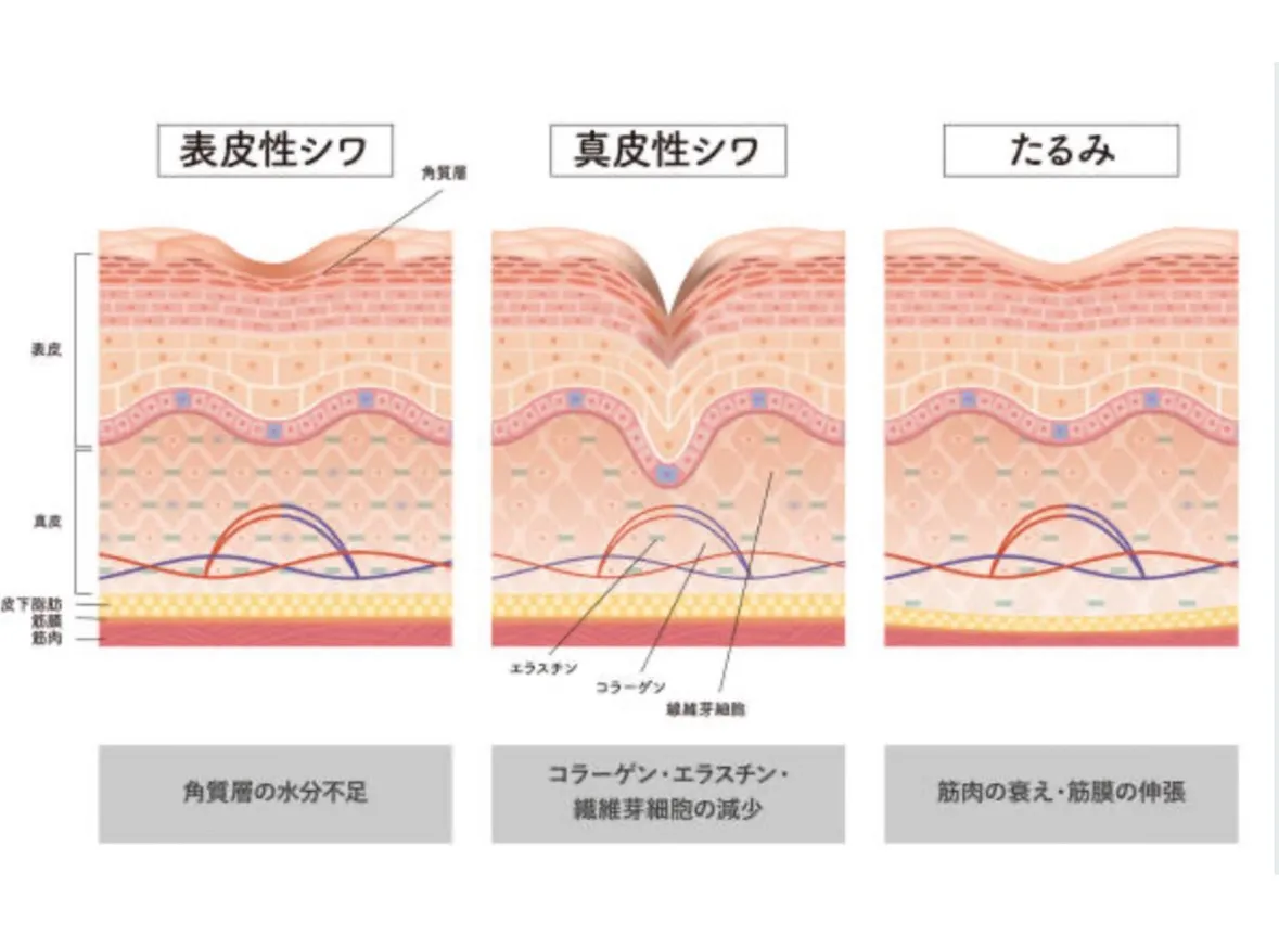 脂肪を増やして若返る⁉︎注射しない最新施術！！
